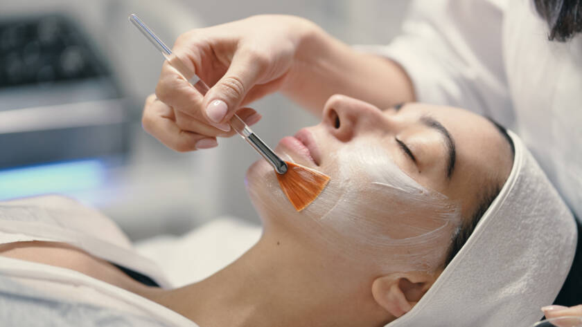 Chemical Peels for Acne Scars and Treatment | Vasavi Hair & Skin Center