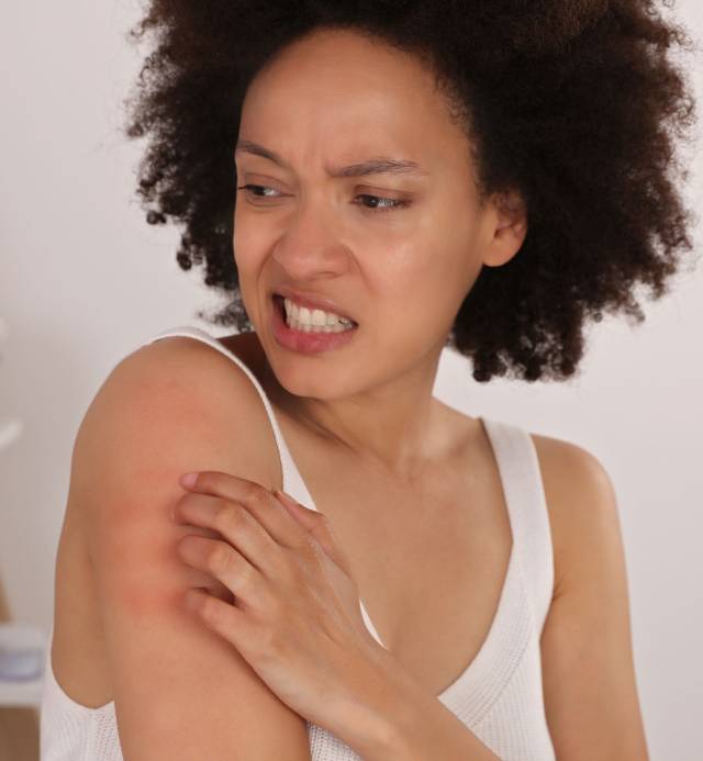 vasavi skin center - eczema